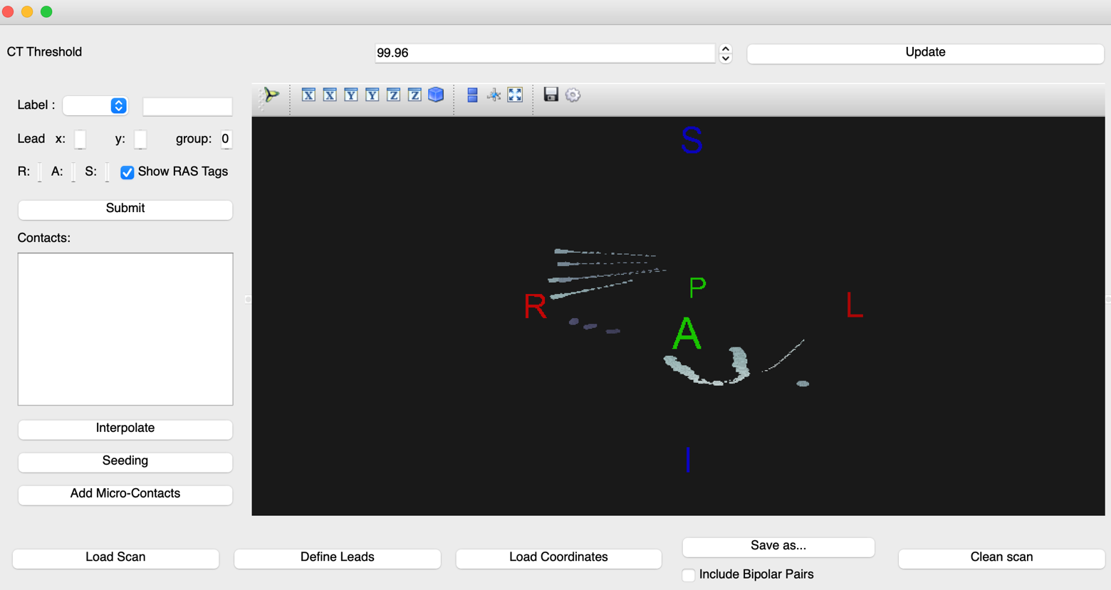 VoxTool window with CT electrode point cloud, no identifiers