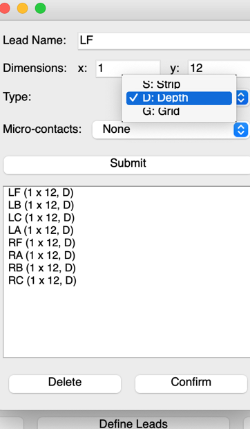 VoxTool Define Leads dialog with lead names LF/LB/RA etc.