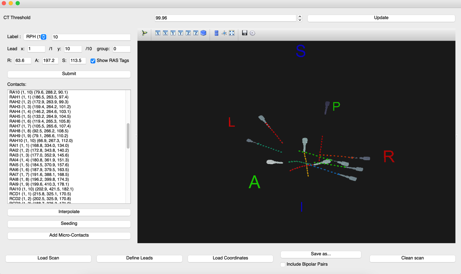 voxTool with labeled contacts (duplicate)